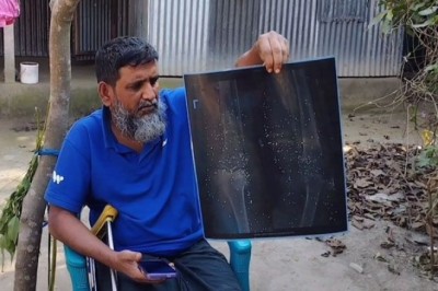 জুলাই বিপ্লবে আহত সুজনের দুর্বিষহ জীবন